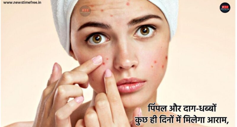 Face pack for pimples